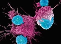 BRINDISI : ASL : TERAPIE CAR-T : GIORNATA DI APPROFONDIMENTO