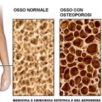 Giornata contro l�osteoporosi_2015