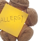 "Update in Allergologia e Immunologia Clinica" Brindisi 27 e 28 settembre 2013 Gran Albergo Internazionale